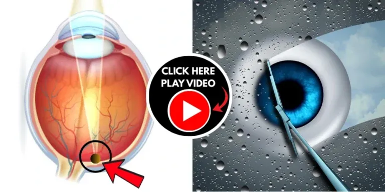 Frozen Blueberry Protocol